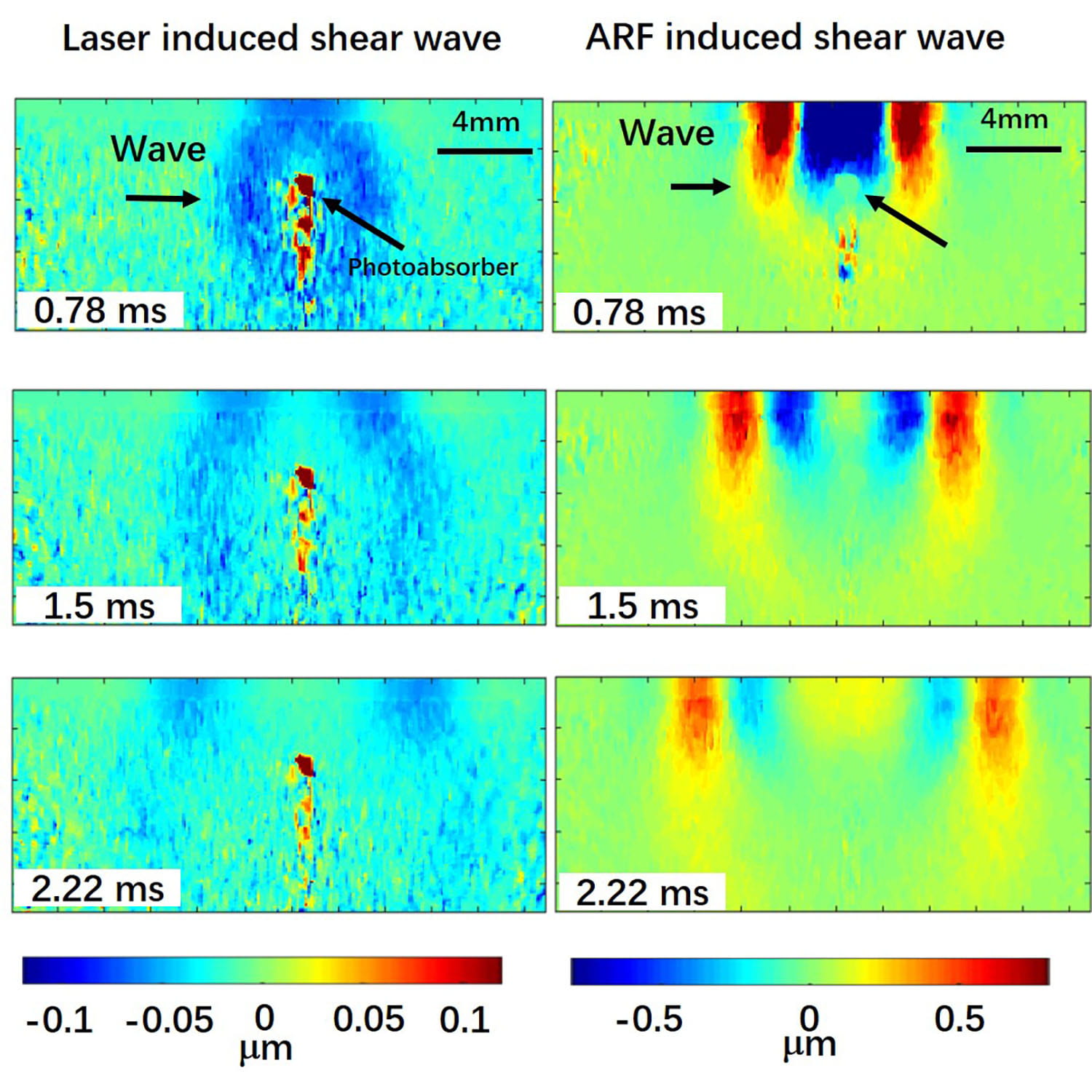 Laser-Induce Shear Wave Elasticity Imaging